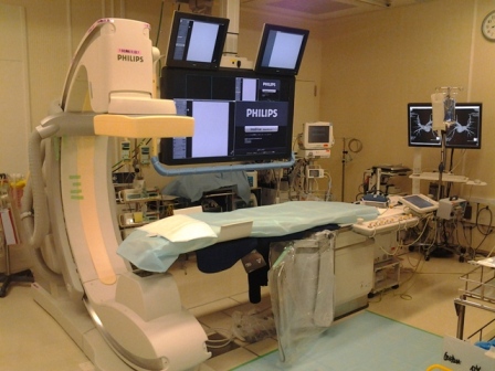 アンギオ装置 アンギオ装置