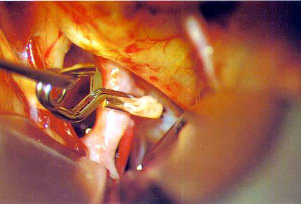 クリッピング後